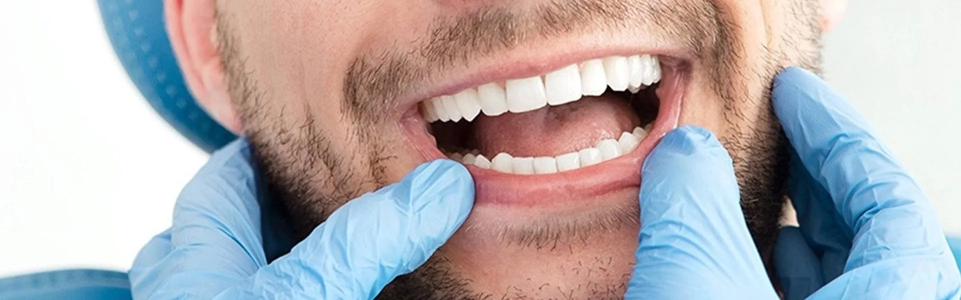 Dental Bonding in Aurora | Expert Tooth Repair