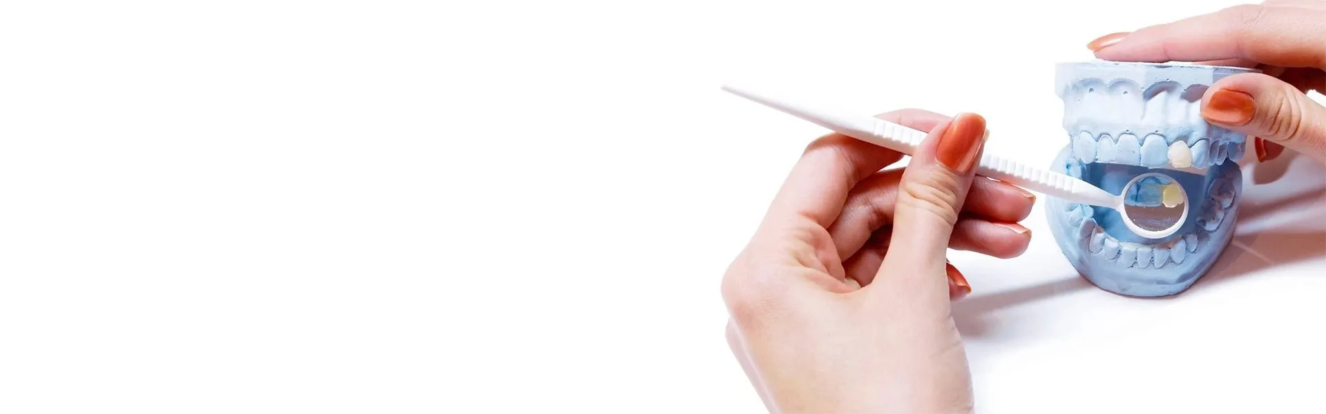 Dental Inlays in Aurora | Dental Onlays in Aurora